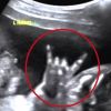 Video: 'Rockstar' child inside womb shows devil's horn in ultrasound