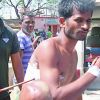 Odisha: Youth hit by arrow in group clash