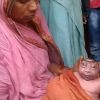 Child born with deformed features termed alien, supernatural in Bihar