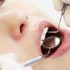 Researchers create new dental material to kill microbes and resist plaque