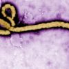 Anti-bodies that fight Ebola viruses are now a reality