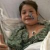 10-year-old miraculously survives after kebab skewer impaled his skull