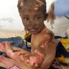 Harrowing images show Syrian children burnt by ‘Napalm bomb’ air strikes
