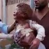 Video shows Syrians using wet mud to treat girl burnt by deadly ‘Napalm bombing’