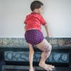 Delhi boy’s leg swells to four times its size due to genetic disorder