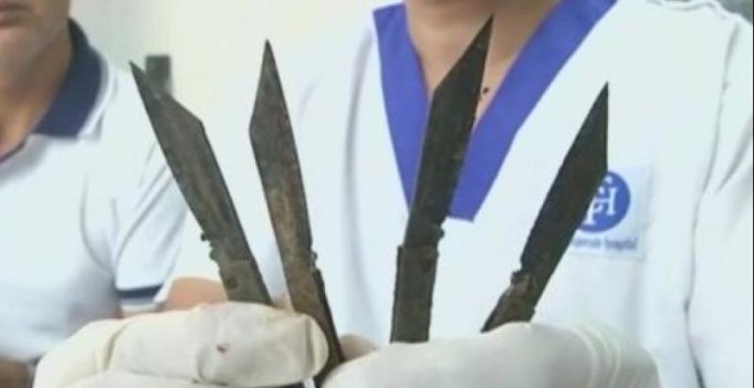 Video: Man swallows 40 knives in 2 months, blames it on spiritual powers