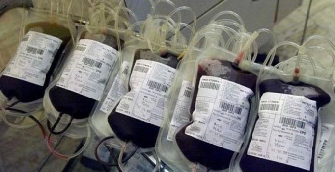Thalassemia patient stated to have contracted HIV from infected blood