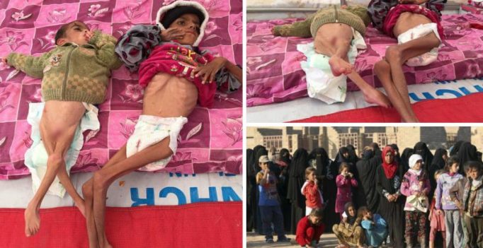 Mosul’s skeleton children: Kids starve to death in ISIS battleground