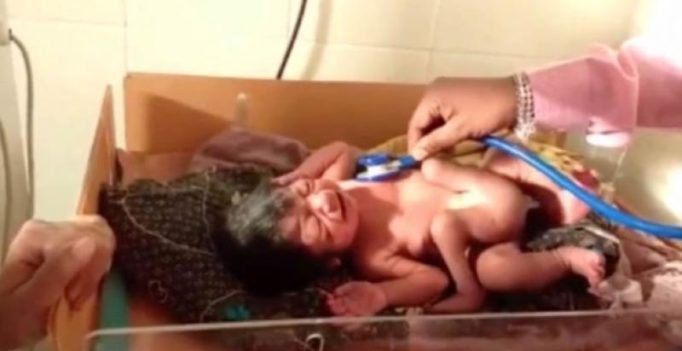 Video: Karnataka child born with four legs, two penises described as god’s gift