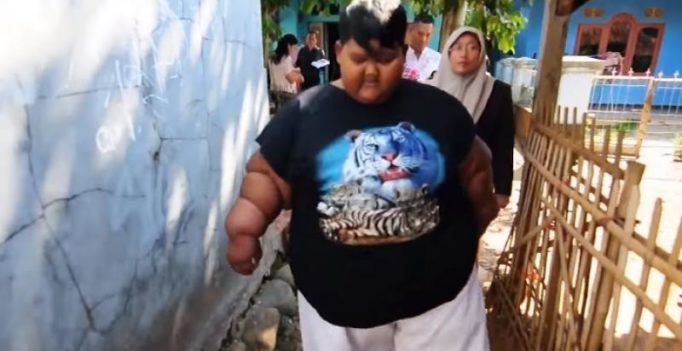 Video: 10-year-old from Indonesia weighs 190 kg due to noodle, cola addiction