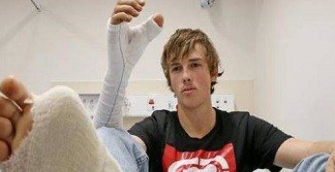 Australian man’s thumb severed in cattle herding surgically replaced with toe