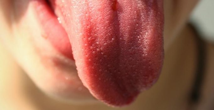 Pregnant wife bites off man’s tongue while kissing as he wasn’t ‘good looking’